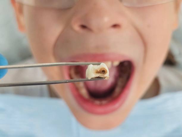 Best Emergency Pediatric Dental Care in Medford, NY